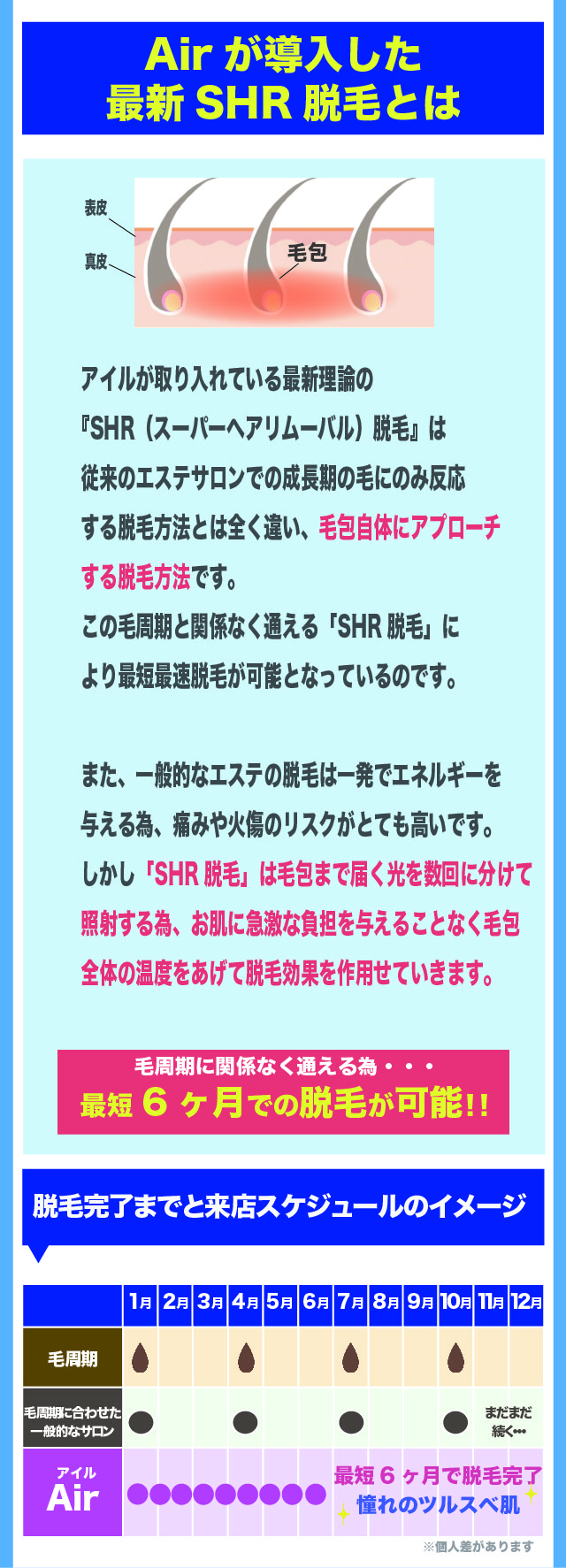 SHR脱毛とは